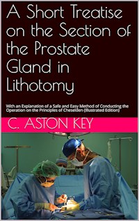 A Short Treatise on the Section of the Prostate Gland in Lithotomy - Charles Aston Key - E-Book