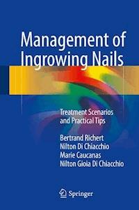 Management of Ingrowing Nails - Bertrand Richert - E-Book
