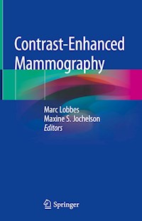 Contrast-Enhanced Mammography -  - E-Book