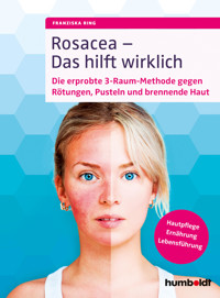 Rosacea – Das hilft wirklich - Franziska Ring - E-Book