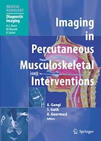 Imaging in Percutaneous Musculoskeletal Interventions -  - E-Book