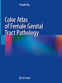 Color Atlas of Female Genital Tract Pathology - Pranab Dey - E-Book