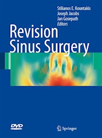 Revision Sinus Surgery -  - E-Book