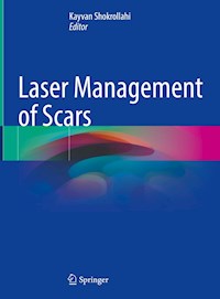 Laser Management of Scars - - E-Book
