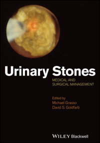 Urinary Stones -  - E-Book