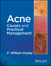 Acne - F. William Danby - E-Book