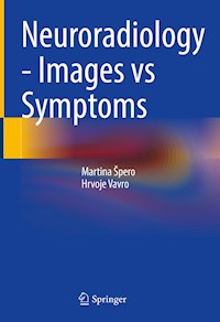 Neuroradiology - Images vs Symptoms - Martina Špero - E-Book