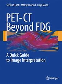 PET-CT Beyond FDG - Stefano Fanti - E-Book