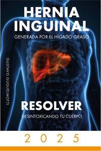 HERNIA INGUINAL - Gustavo Guglielmotti - E-Book