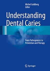 Understanding Dental Caries -  - E-Book