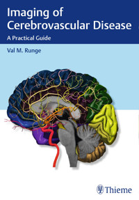Imaging of Cerebrovascular Disease - Val M. Runge - E-Book