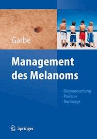 Management des Melanoms -  - E-Book