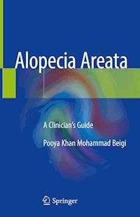 Alopecia Areata - Pooya Khan Mohammad Beigi - E-Book