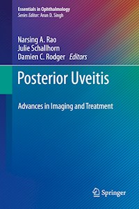 Posterior Uveitis -  - E-Book
