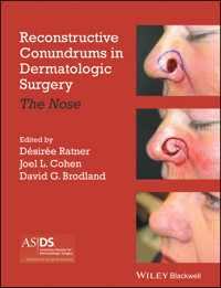 Reconstructive Conundrums in Dermatologic Surgery -  - E-Book