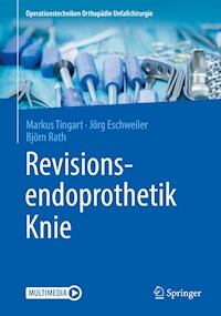 Revisionsendoprothetik Knie - Markus Tingart - E-Book