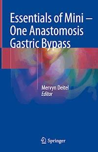 Essentials of Mini ‒ One Anastomosis Gastric Bypass -  - E-Book