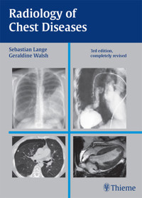 Radiology of Chest Diseases - Sebastian Lange - E-Book
