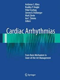 Cardiac Arrhythmias - - E-Book