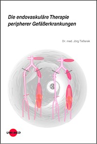 Die endovaskuläre Therapie peripherer Gefäßerkrankungen - Jörg Teßarek - E-Book