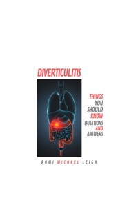 Diverticulitis - Rumi Michael Leigh - E-Book