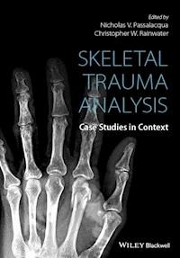Skeletal Trauma Analysis -  - E-Book