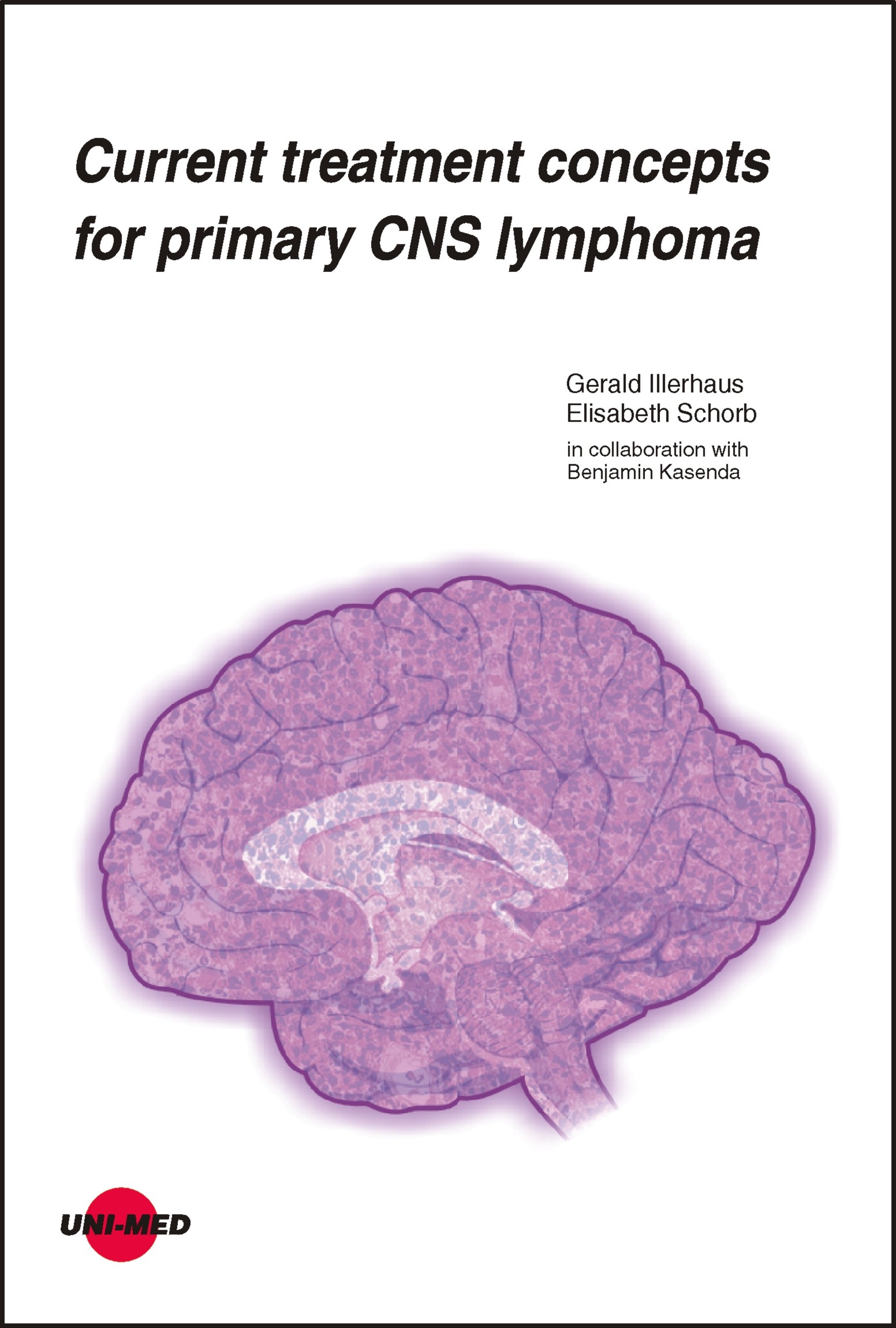 Current treatment concepts for primary CNS lymphoma - Gerald Illerhaus - E-Book