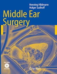Middle Ear Surgery - Henning Hildmann - E-Book