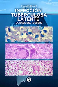 Infección Tuberculosa Latente, la base del iceberg - Fernando Biasutti - E-Book