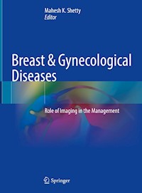 Breast & Gynecological Diseases -  - E-Book