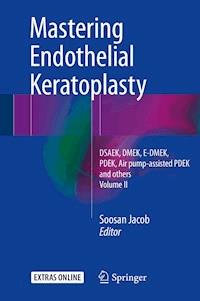 Mastering Endothelial Keratoplasty -  - E-Book