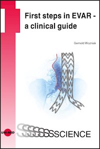 First steps in EVAR - a clinical guide - Gernold Wozniak - E-Book
