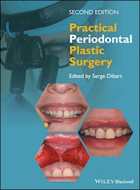 Practical Periodontal Plastic Surgery -  - E-Book