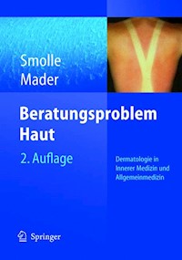Beratungsproblem Haut - Josef Smolle - E-Book