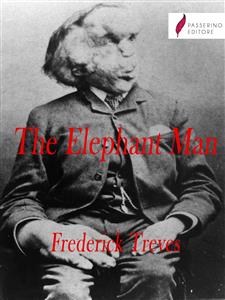 The Elephant Man - Frederick Treves - E-Book