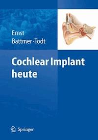 Cochlear Implant heute -  - E-Book
