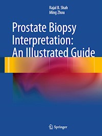 Prostate Biopsy Interpretation: An Illustrated Guide - Rajal B. Shah - E-Book
