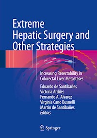 Extreme Hepatic Surgery and Other Strategies - - E-Book