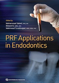 PRF Applications in Endodontics - Mohammad Sabeti - E-Book