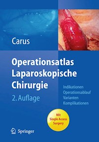 Operationsatlas Laparoskopische Chirurgie - Thomas Carus - E-Book