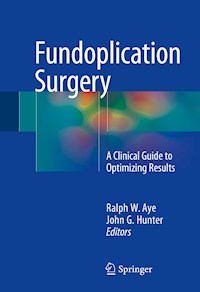 Fundoplication Surgery -  - E-Book