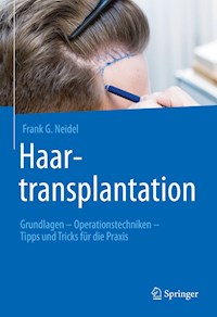 Haartransplantation - Frank G. Neidel - E-Book