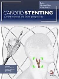 Carotid Stenting - Giovanni Nano - E-Book