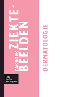 Zakboek ziektebeelden - Dermatologie - Karin Linden - E-Book