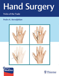 Hand Surgery - Pedro Beredjiklian - E-Book