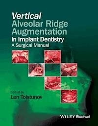 Vertical Alveolar Ridge Augmentation in Implant Dentistry -  - E-Book