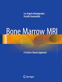 Bone Marrow MRI - Lia Angela Moulopoulos - E-Book