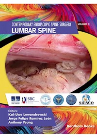 Lumbar Spine -  - E-Book