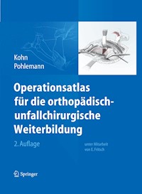 Operationsatlas für die orthopädisch-unfallchirurgische Weiterbildung - Dieter Kohn - E-Book