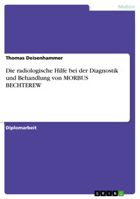 Die radiologische Hilfe bei der Diagnostik und Behandlung von MORBUS BECHTEREW - Thomas Deisenhammer - E-Book